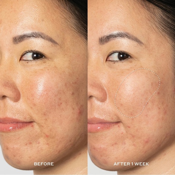 Ole Henriksen Dark Spot Toner 7% AHAs - Picture 8 of 16